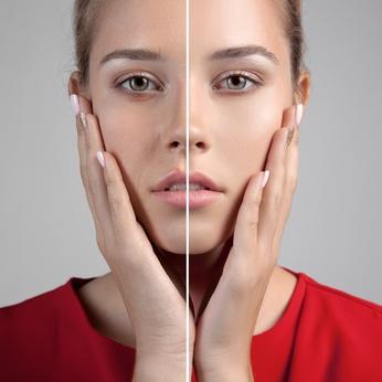 وجه imperfections