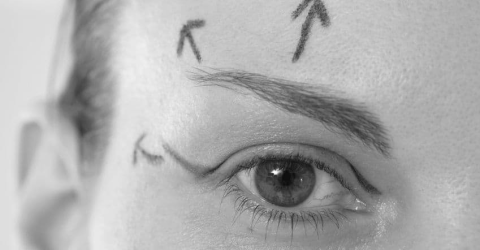 traitement des paupieres