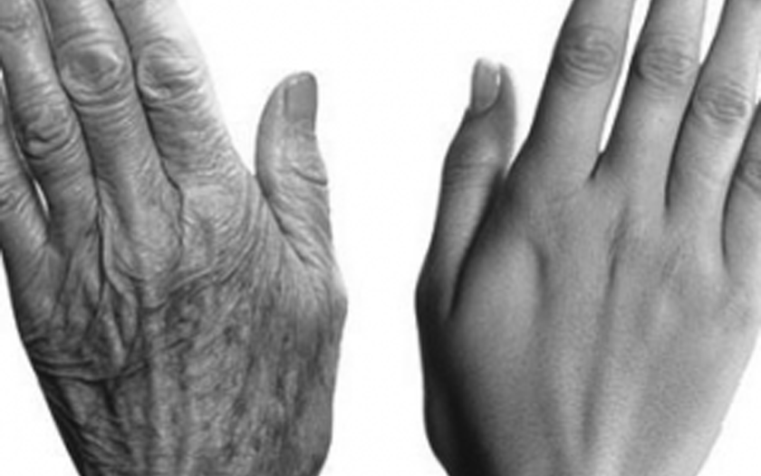 تجديد شباب اليدين