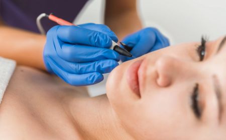 Epilation electrique