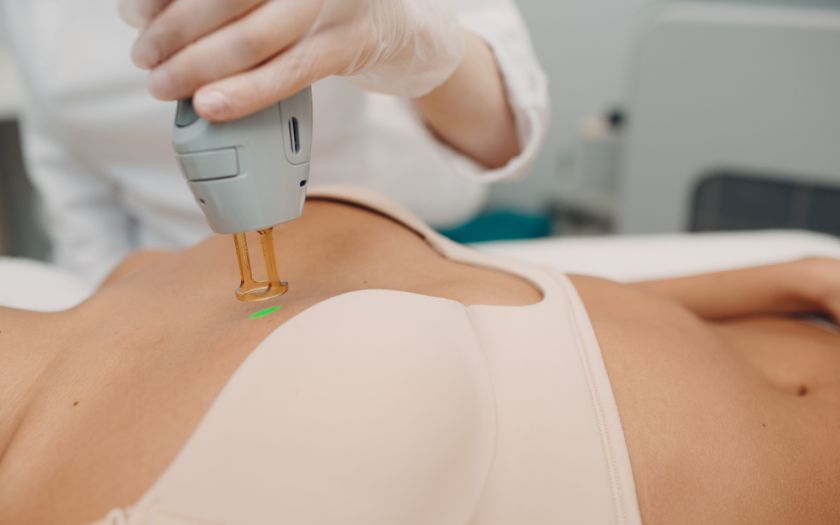 Epilation laser seins