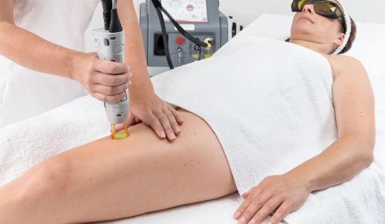 Epilation laser jambes completes