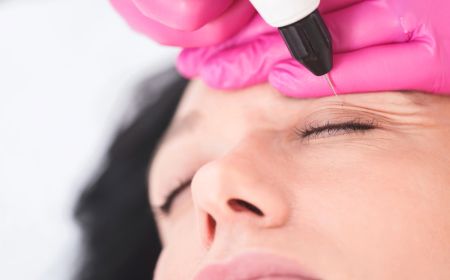 quelle est la difference entre le plexr et la chirurgie blepharoplastie