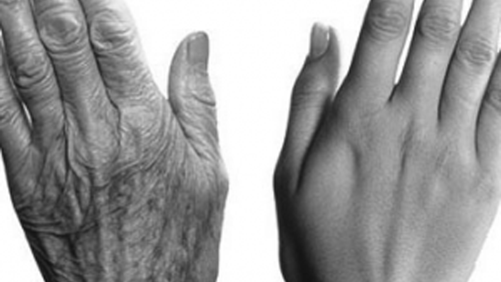 rajeunissement des mains