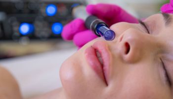 Microneedling